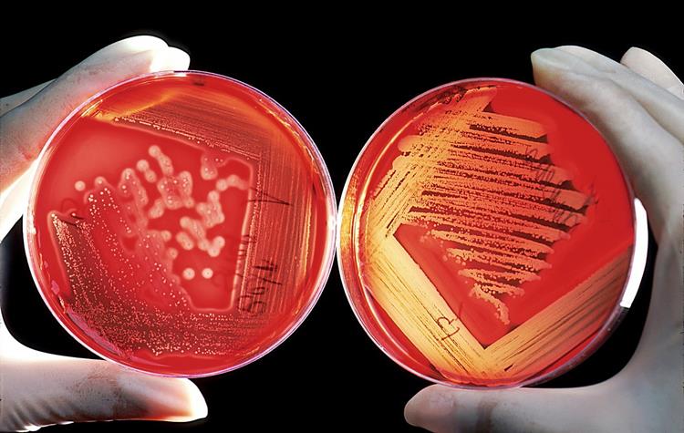Health-i-care kämpft grenzüberschreitend gegen Bakterien